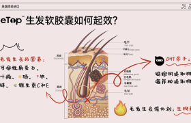 NiceTop所先养发胶囊双管齐下 从根源解决脱发难题